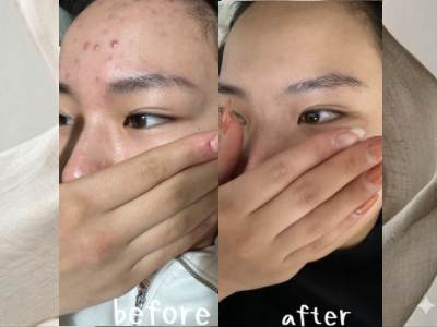 Before After 09